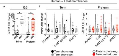 IL-1 and TNF mediates IL-6 signaling at the maternal-fetal interface during intrauterine inflammation